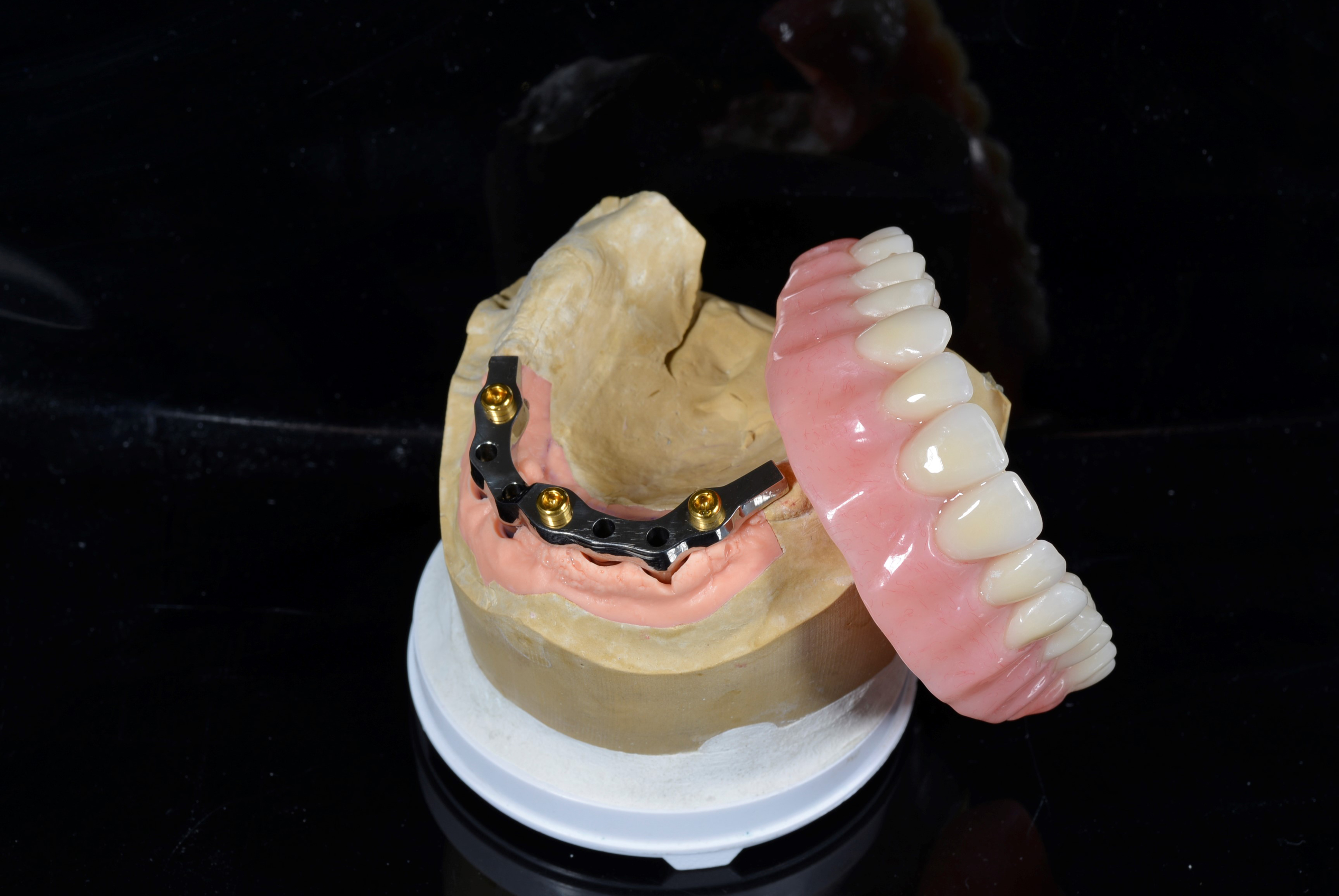 Implants Protech Dental Studio